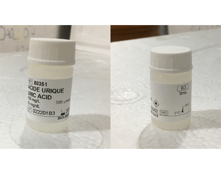 URIC ACID Uricase Method