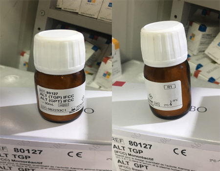 ALT TGP (IFCC) Single Vial