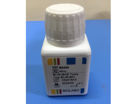 TOTAL BILIRUBIN Sulfanilic Acid Method
