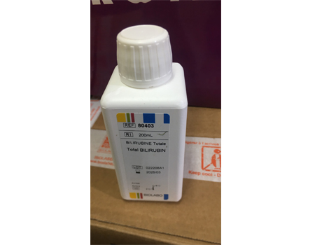 Total and Direct Bilirubin Sulfanilic Acid Method