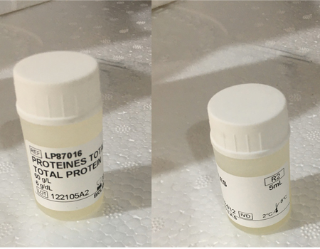 TOTAL PROTEIN Biuret Method Ready to use