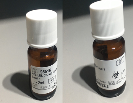 Control serum HDL LDL CK-MB Lipids Level 1 /2