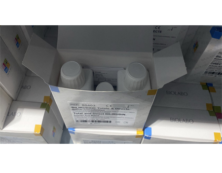 Total and Direct Bilirubin Sulfanilic Acid Method