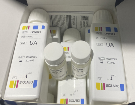URIC ACID Uricase Method Liquid Ready for use