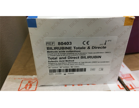 Total and Direct Bilirubin Sulfanilic Acid Method